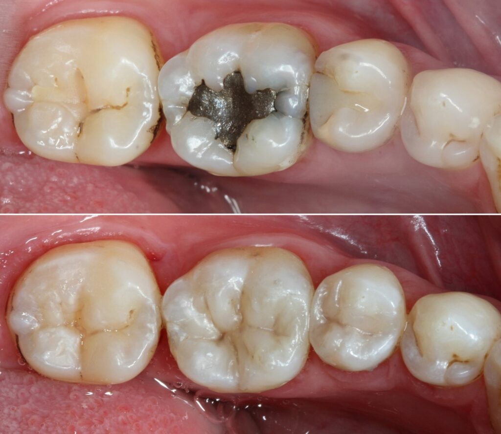 Odontología restauradora